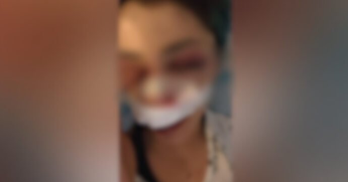 Addetta ai bagni e compagno indagati per violenza e rapina a Bari